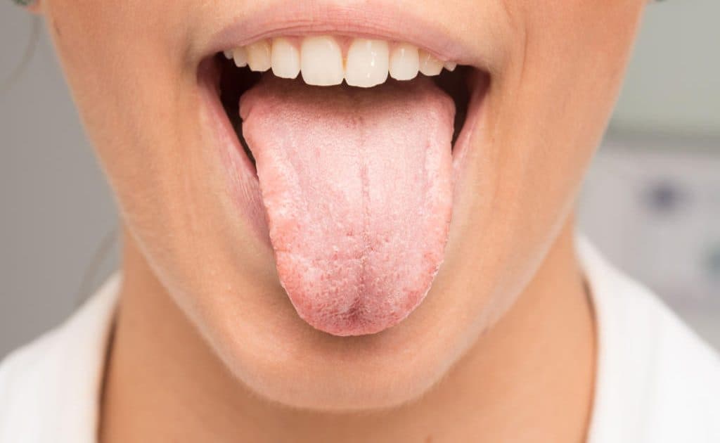 how-to-overcome-bad-mouth-when-fasting