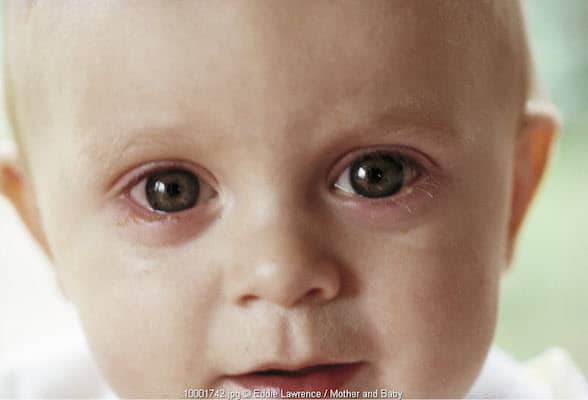 mata merah bayi