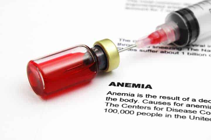 anemia