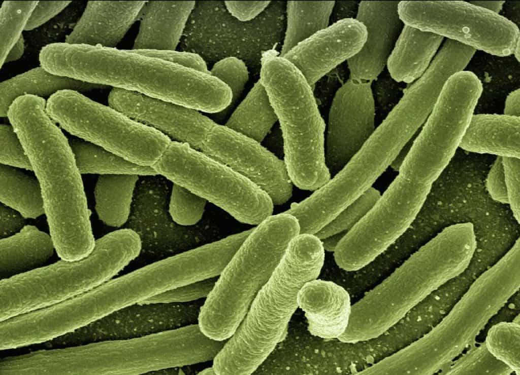 kontaminasi bakteri E. Coli