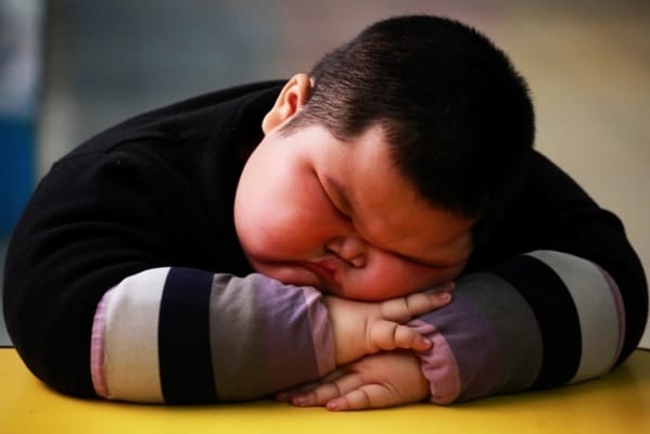 Obesitas pada anak