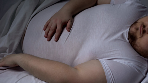 begadang pada obesitas