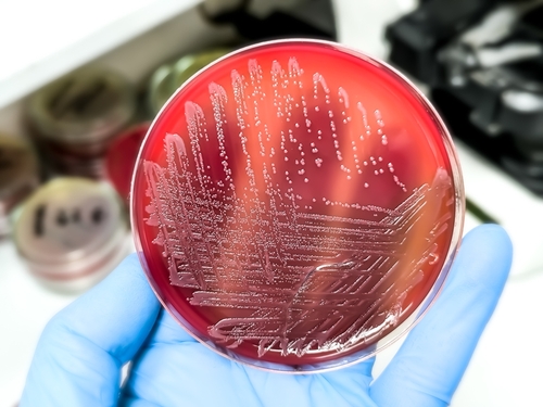 Bakteri Salmonella