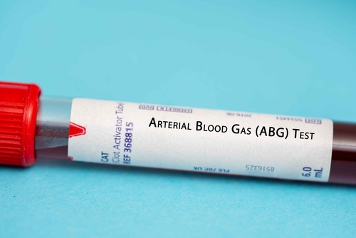 arterial blood gas (ABG)